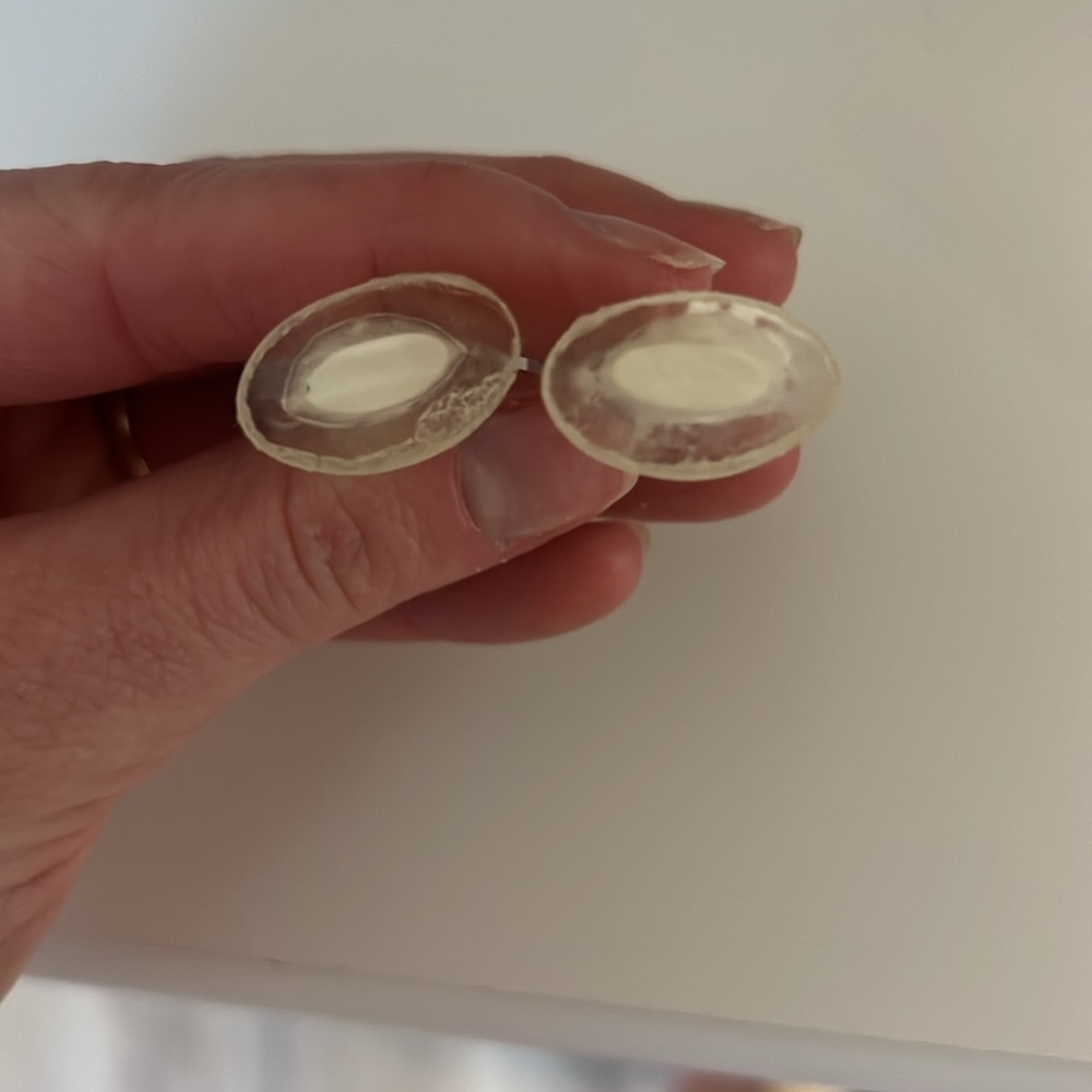 Optic Bridge Cheek Support (Rhinoplasty) - Picture 4 of 6